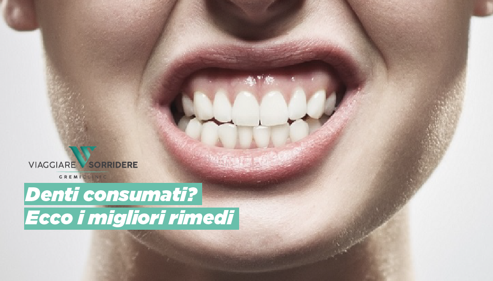 Denti Consumati